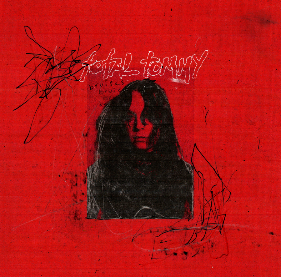 Total Tommy – Bruises